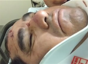 noticia_143511_340x295