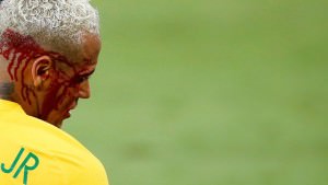 neymar machucado